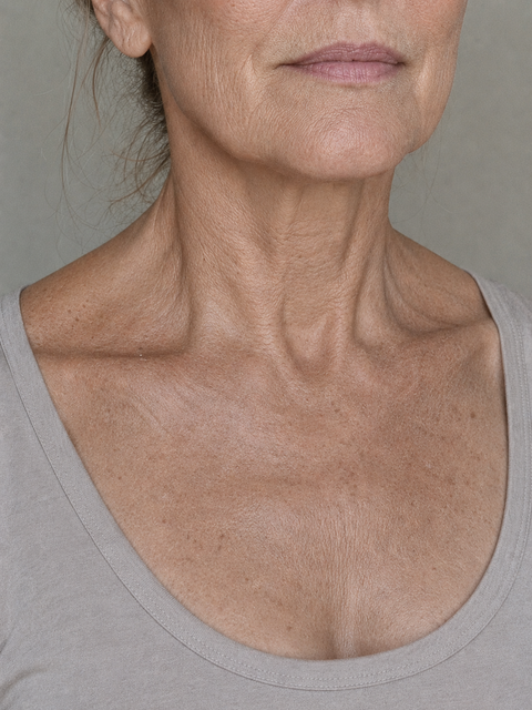 Before — Linda